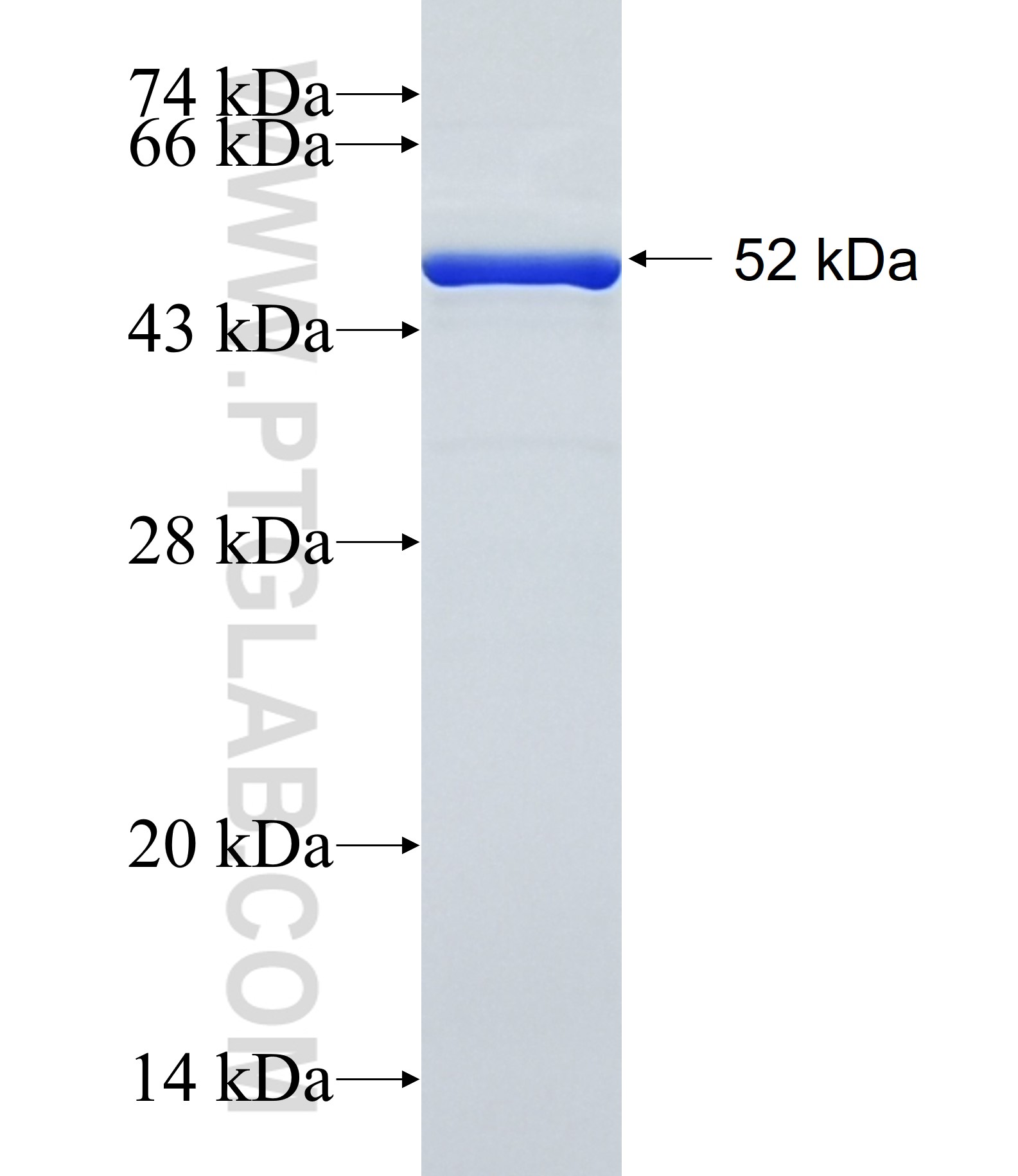 IFI44 fusion protein Ag2326 SDS-PAGE IFI44 fusion protein Ag2326 SDS-PAGE