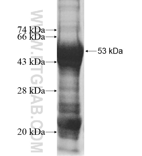 IFI44L fusion protein Ag10501 SDS-PAGE IFI44L fusion protein Ag10501 SDS-PAGE