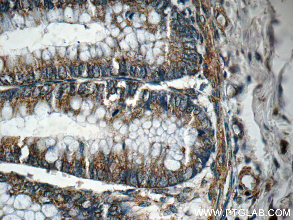 IHC staining of human colon using 11246-1-AP
