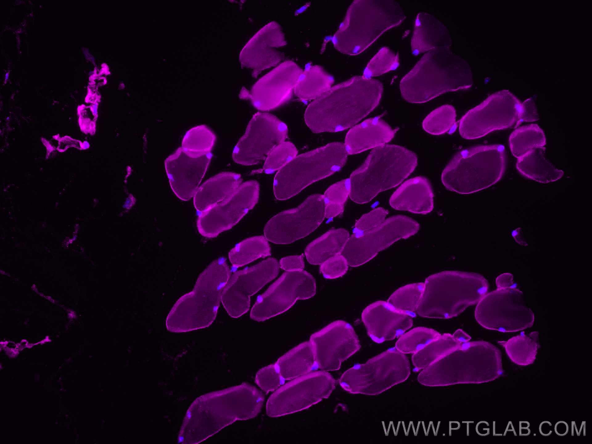 IF Staining of mouse skeletal muscle using 21775-1-AP