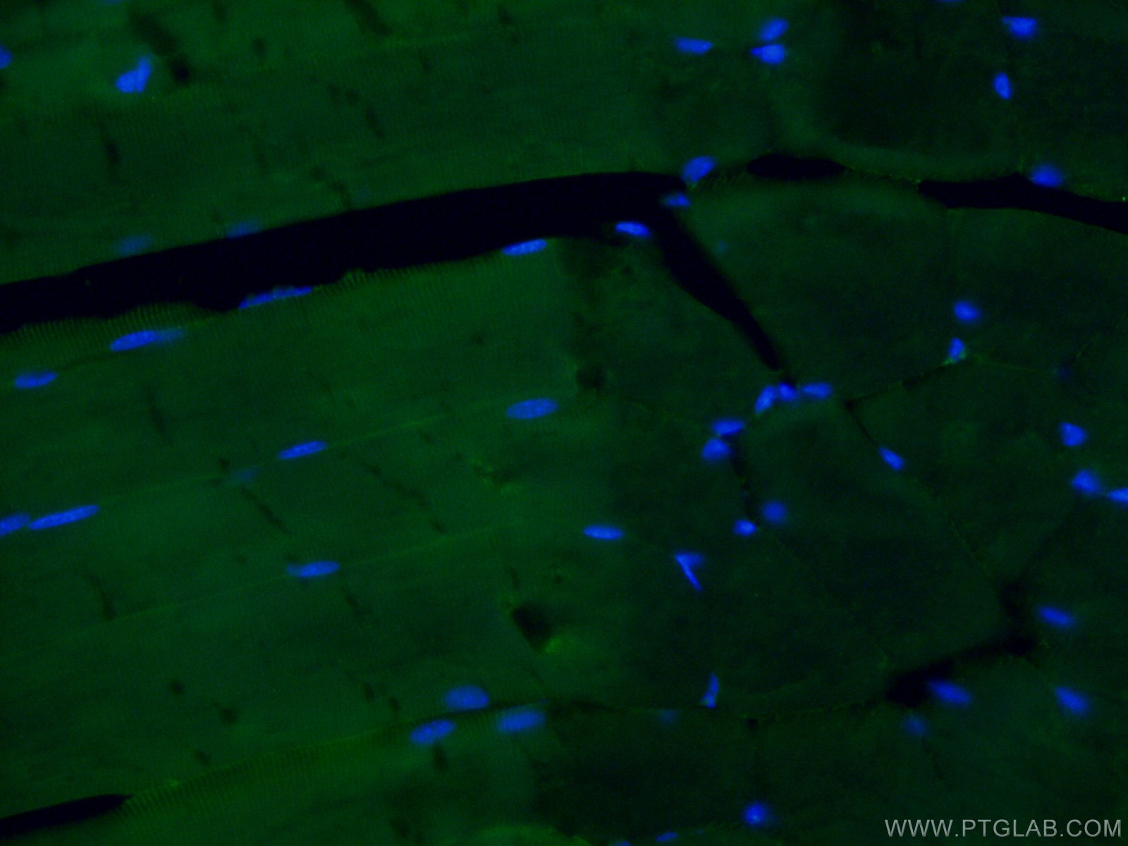 IF Staining of mouse skeletal muscle using CL488-21775
