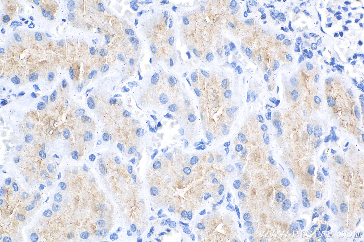 IHC staining of human kidney using 23247-1-AP