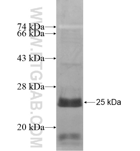 IFIT1L fusion protein Ag15765 SDS-PAGE