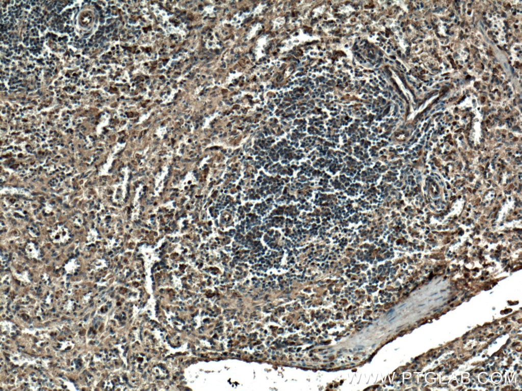 IHC staining of human spleen using 15201-1-AP