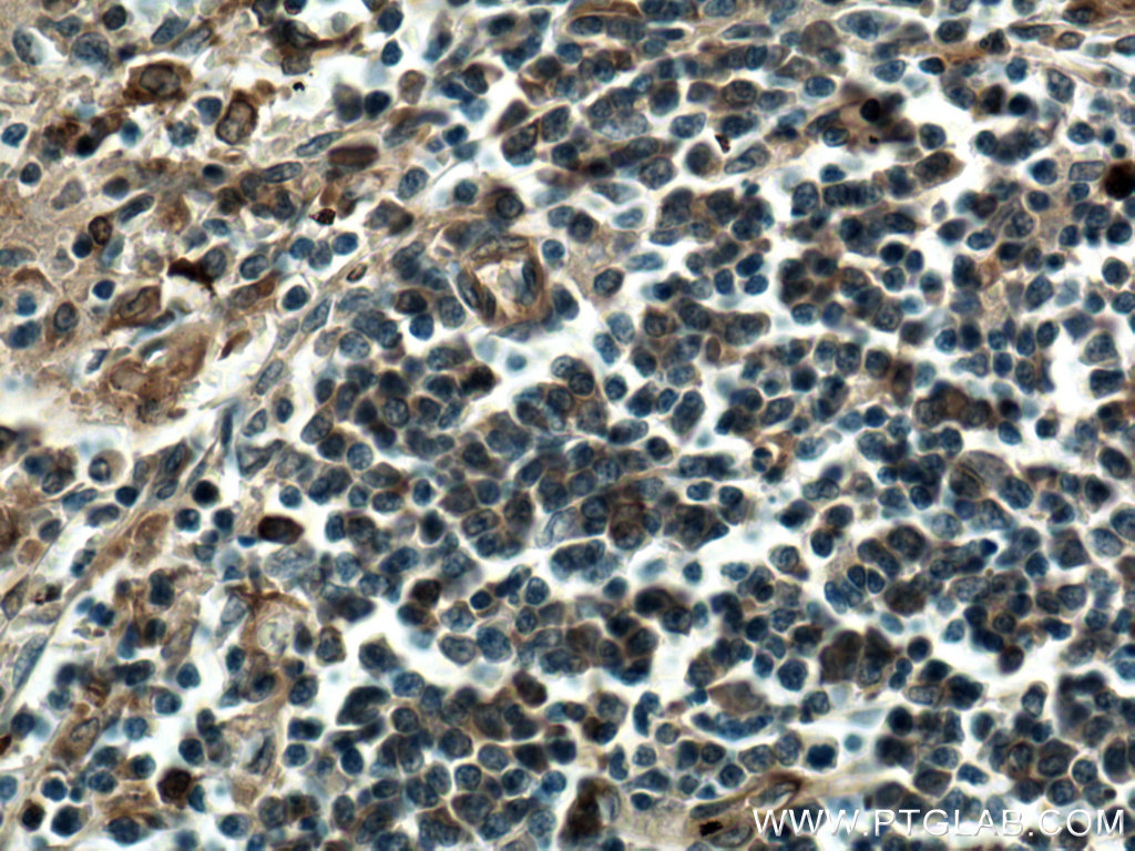 IHC staining of human spleen using 15201-1-AP