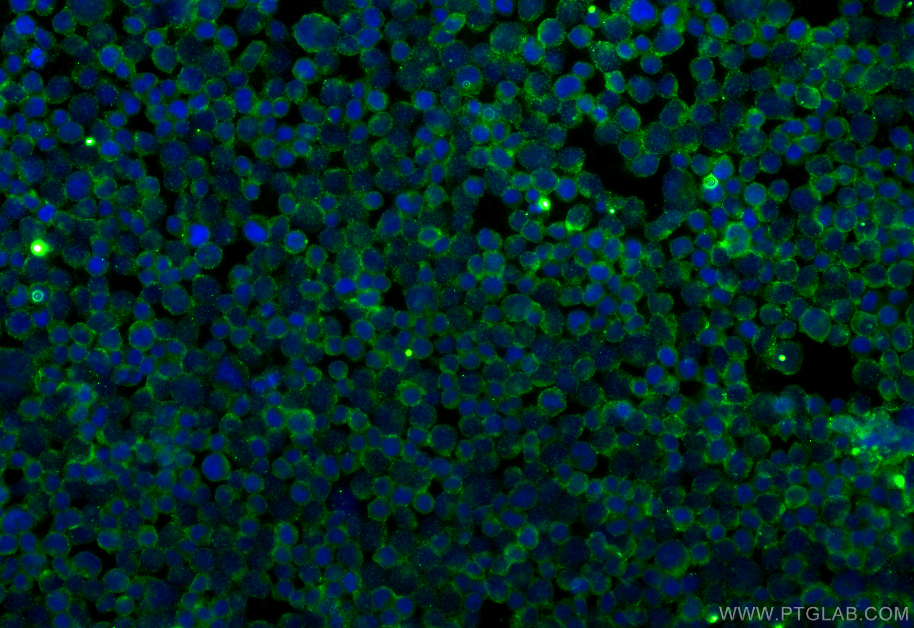 IF Staining of Jurkat using 60074-1-Ig
