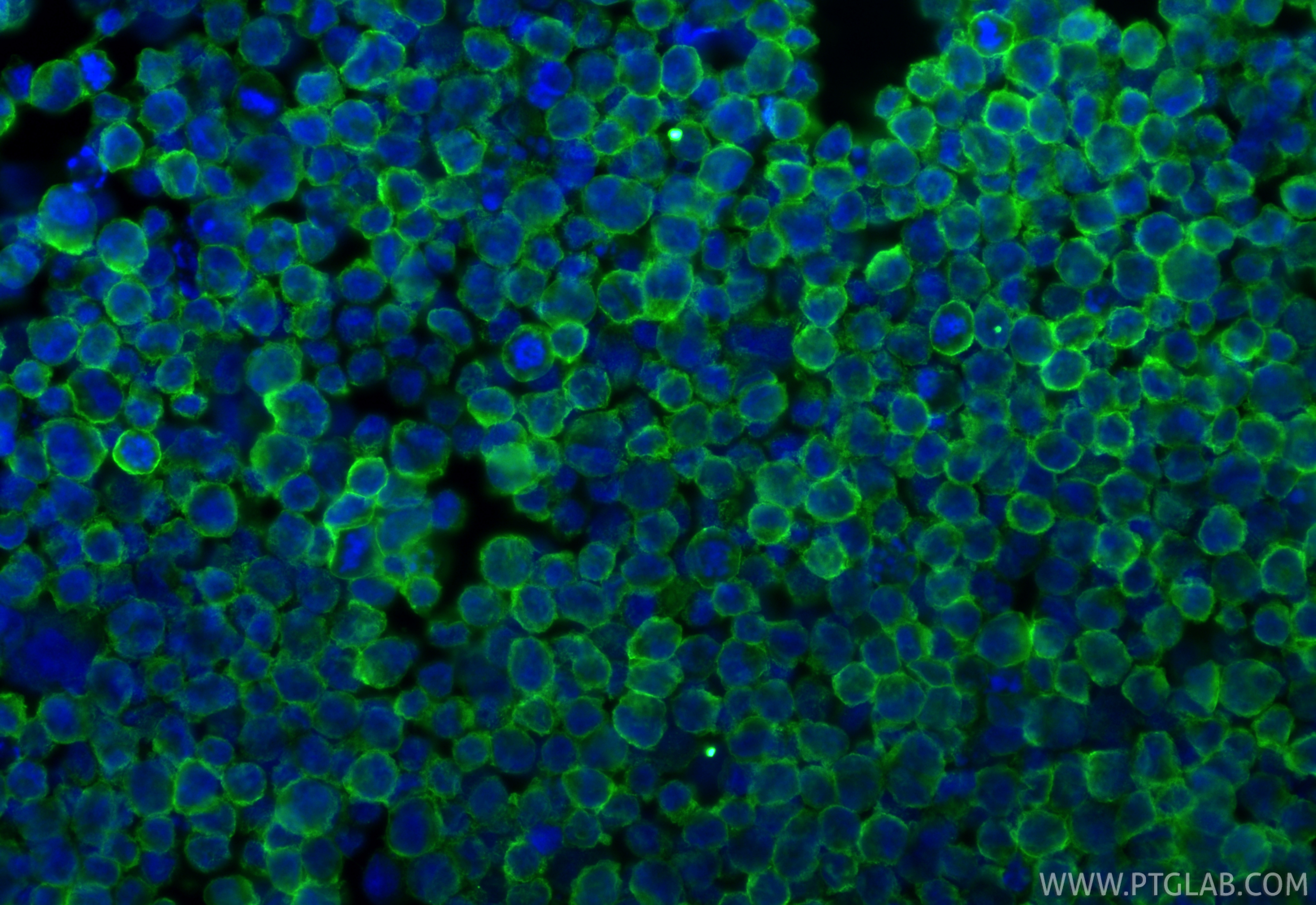 IF Staining of K-562 using 60074-1-Ig