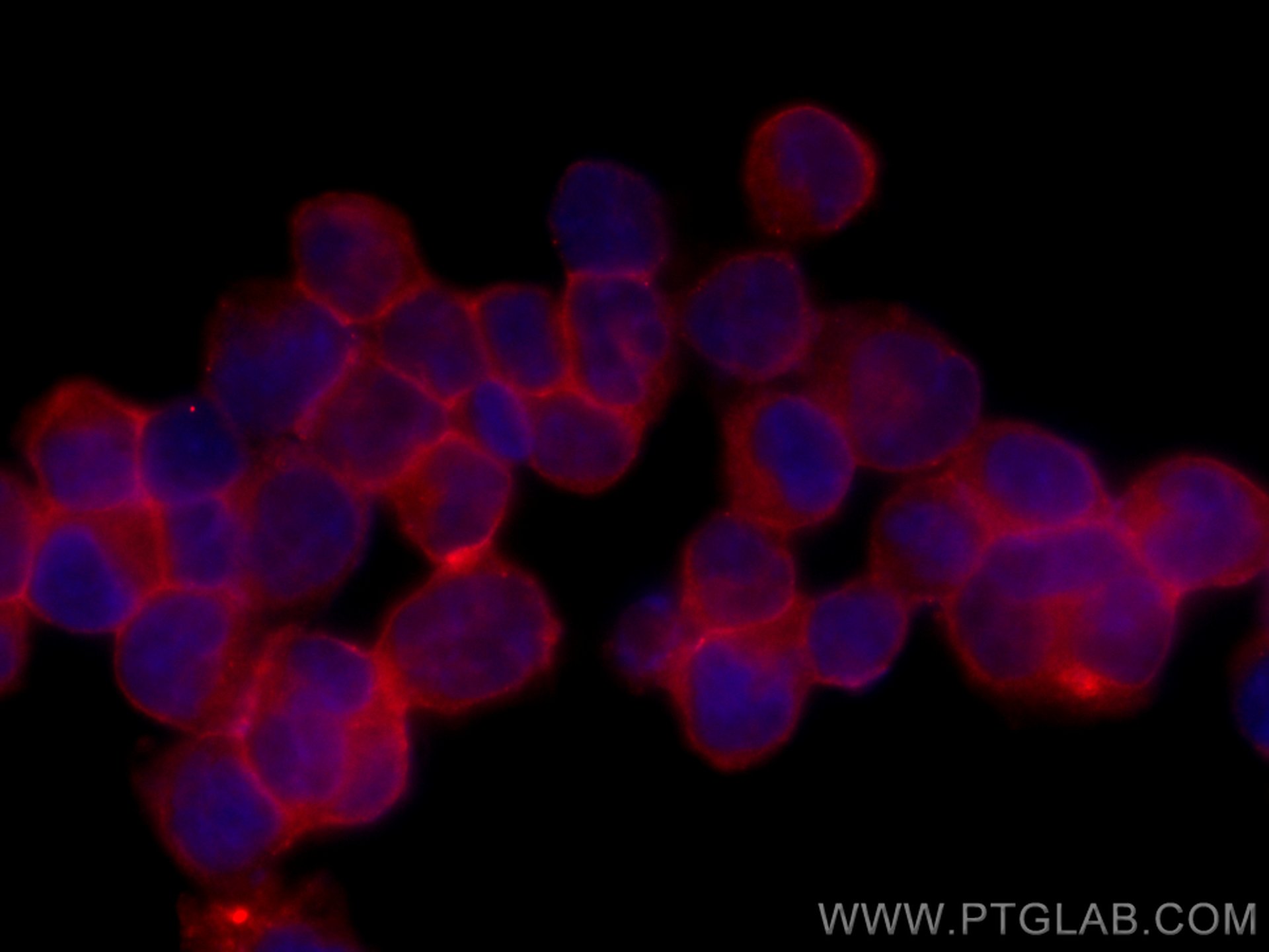 IF Staining of K-562 using CL594-60074