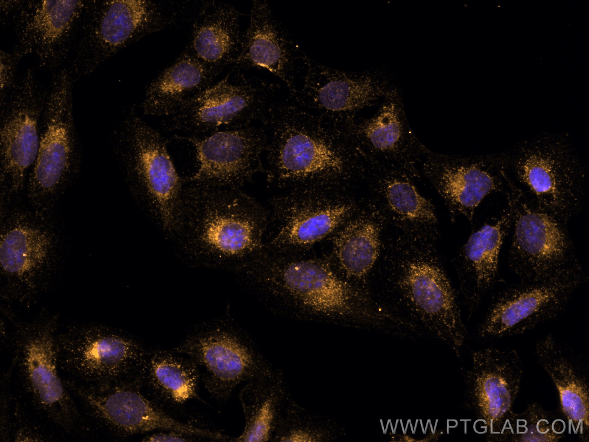 IF Staining of U2OS using CL555-66081