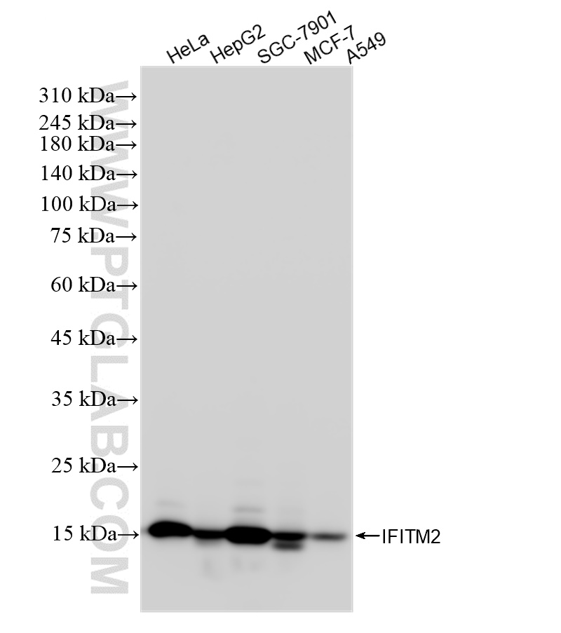 WB analysis using 83455-5-RR
