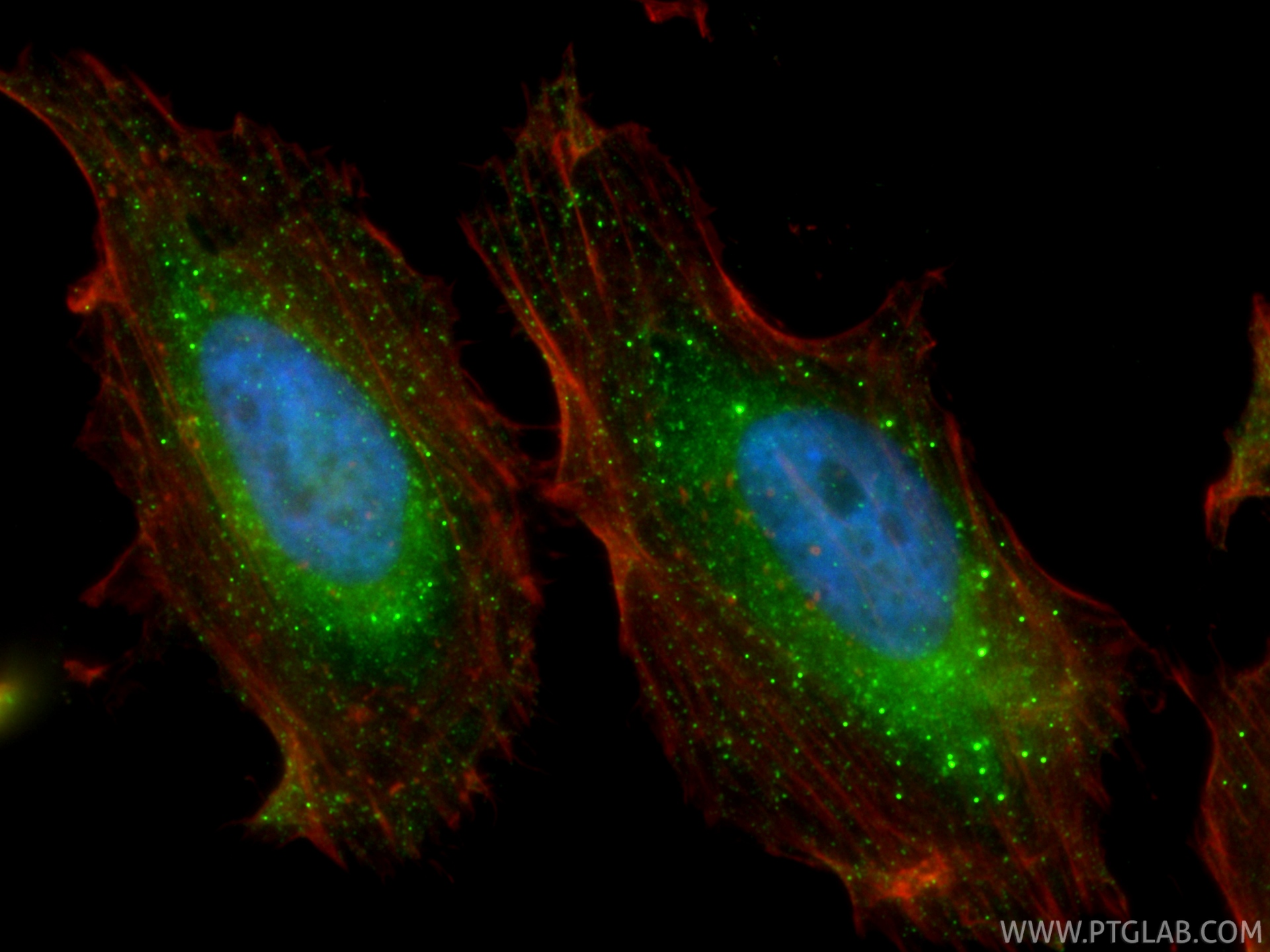 IF Staining of HeLa using CL488-12769 IF Staining of HeLa using CL488-12769