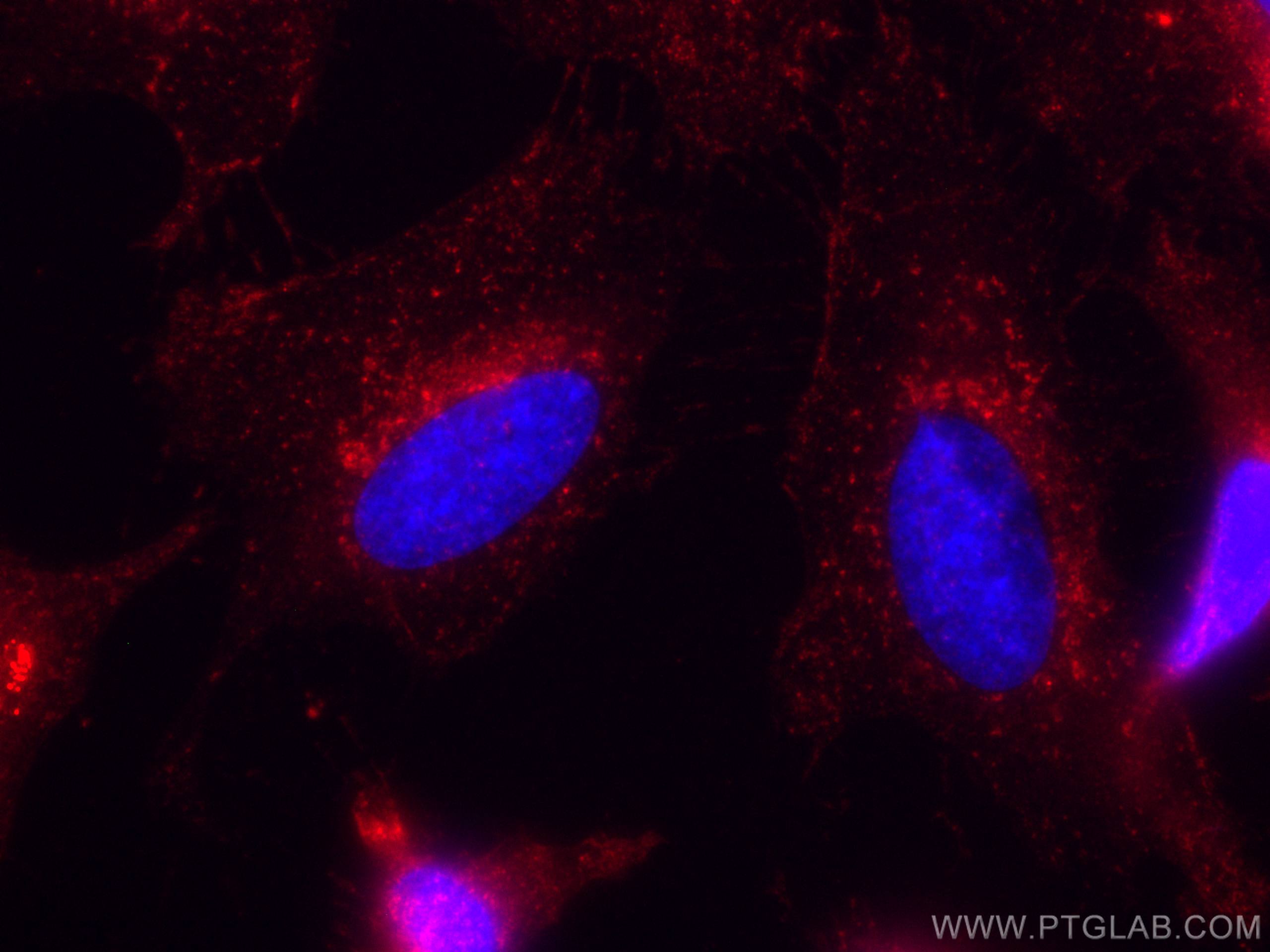 IF Staining of HeLa using CL594-11714