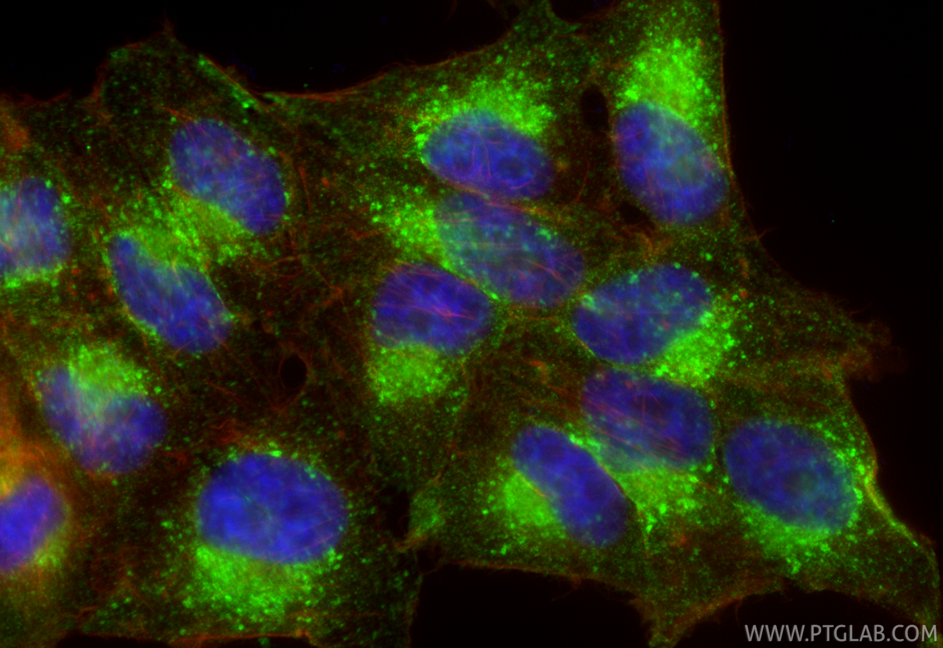 IF Staining of HepG2 using RMX00071 IF Staining of HepG2 using RMX00071