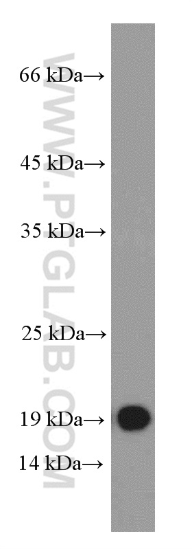 WB analysis of Recombinant protein using 66162-1-Ig