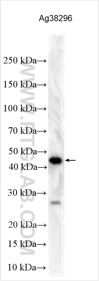 WB analysis using 32690-1-AP WB analysis using 32690-1-AP
