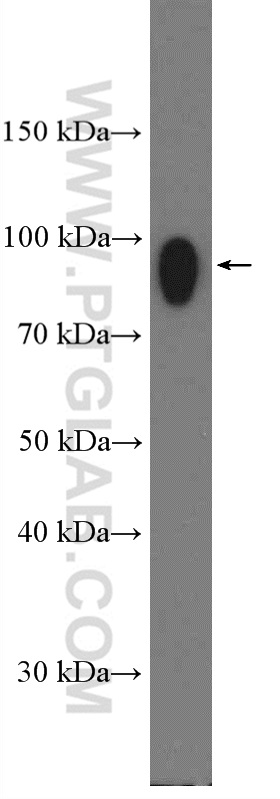 IFNGR1 Polyclonal antibody