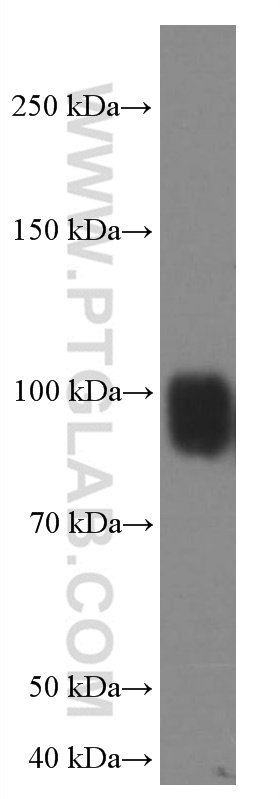 WB analysis of HeLa using 66704-1-Ig (same clone as 66704-1-PBS)