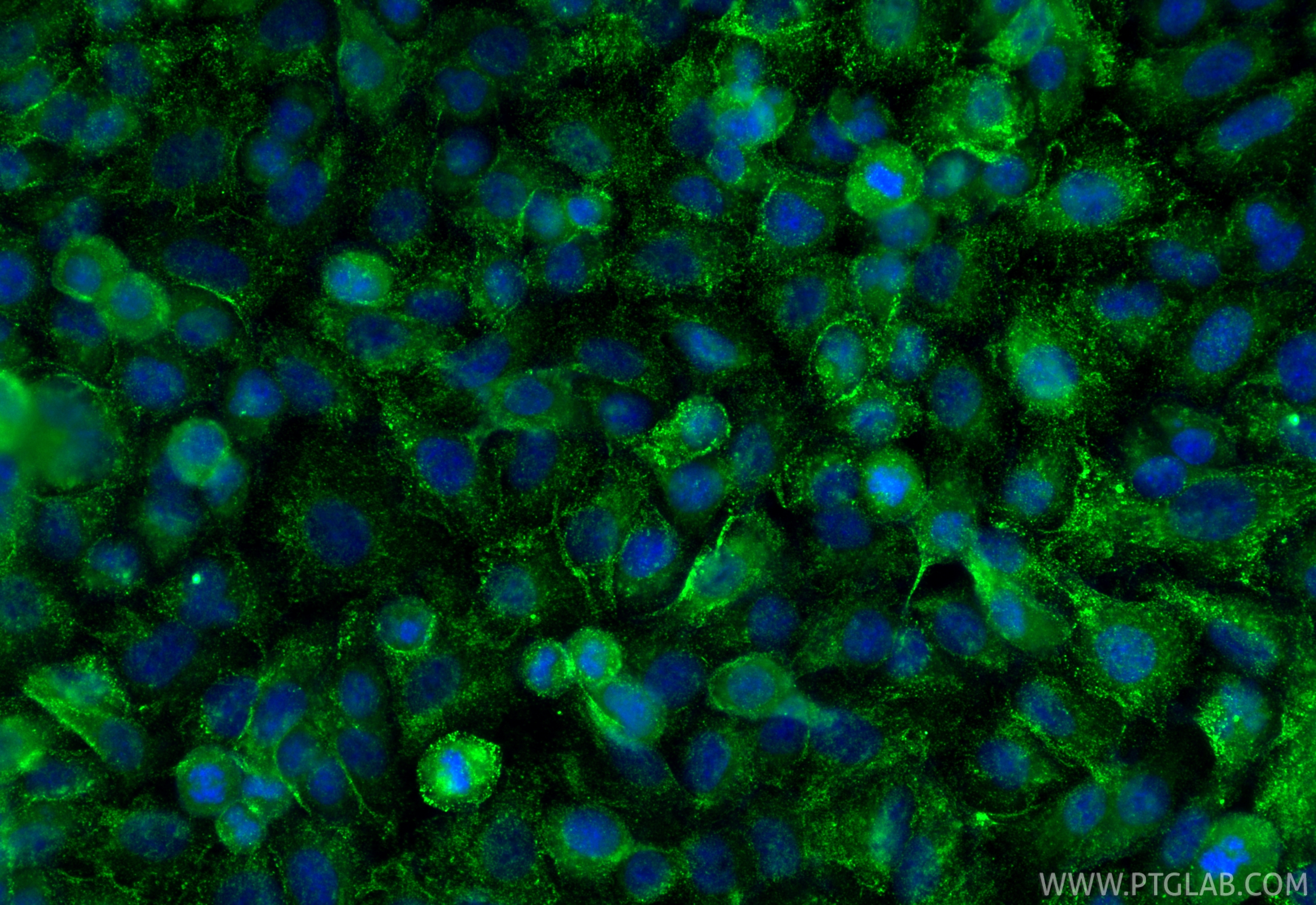IF Staining of A549 using 10266-1-AP