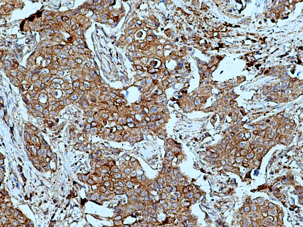 IFN-gamma  R2