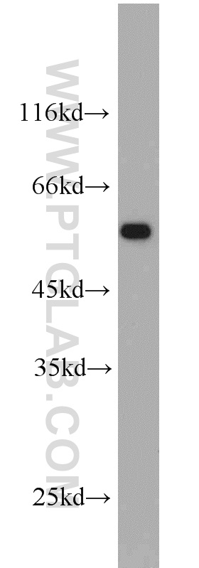 IFNGR2 Polyclonal antibody