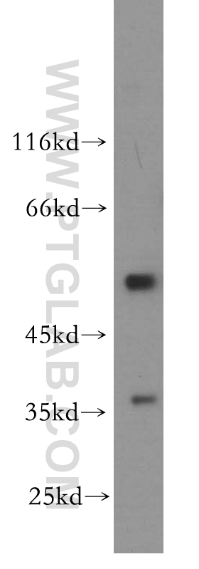 WB analysis of HeLa using 12939-1-AP (same clone as 12939-1-PBS)