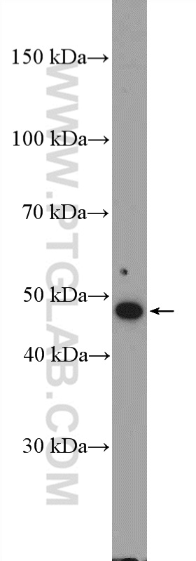 WB analysis of HeLa using 10649-1-AP