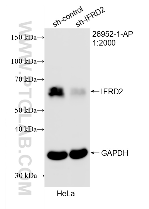 WB analysis of HeLa using 26952-1-AP WB analysis of HeLa using 26952-1-AP