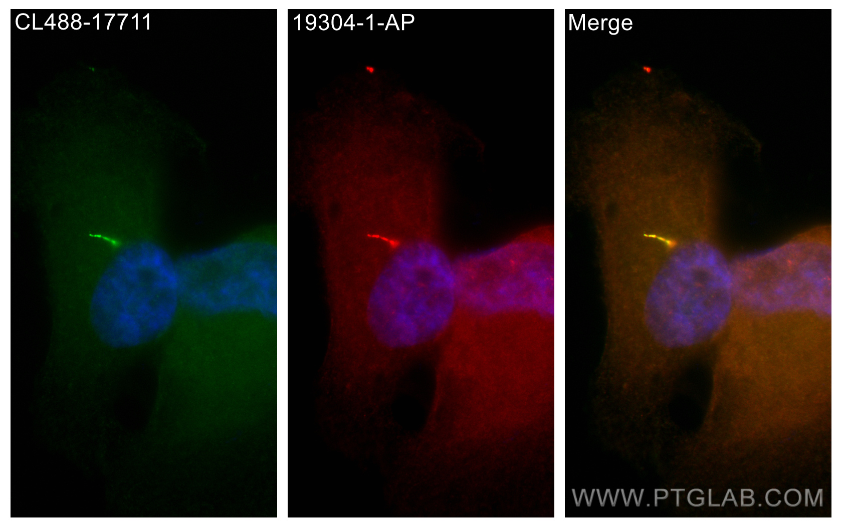 IF Staining of hTERT-RPE1 using 19304-1-AP