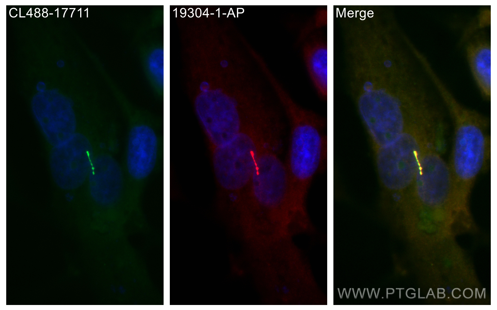 IF Staining of MDCK using 19304-1-AP