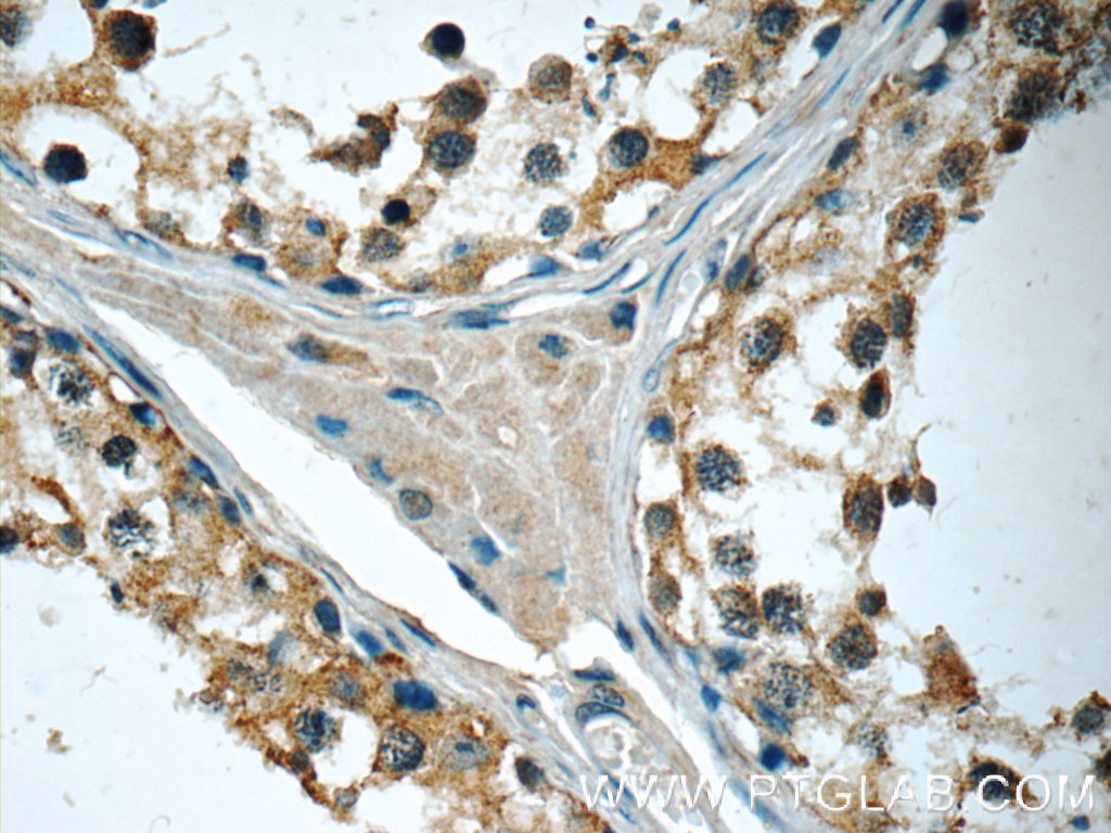 IHC staining of human testis using 19304-1-AP