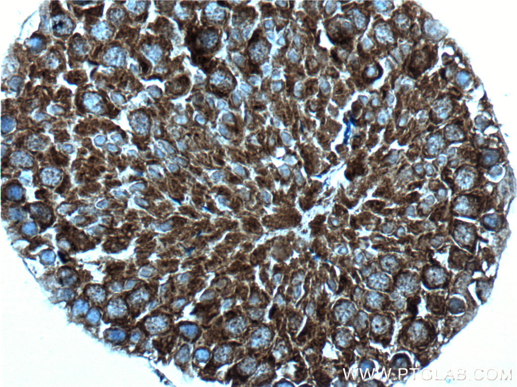 IHC staining of mouse testis using 17460-1-AP