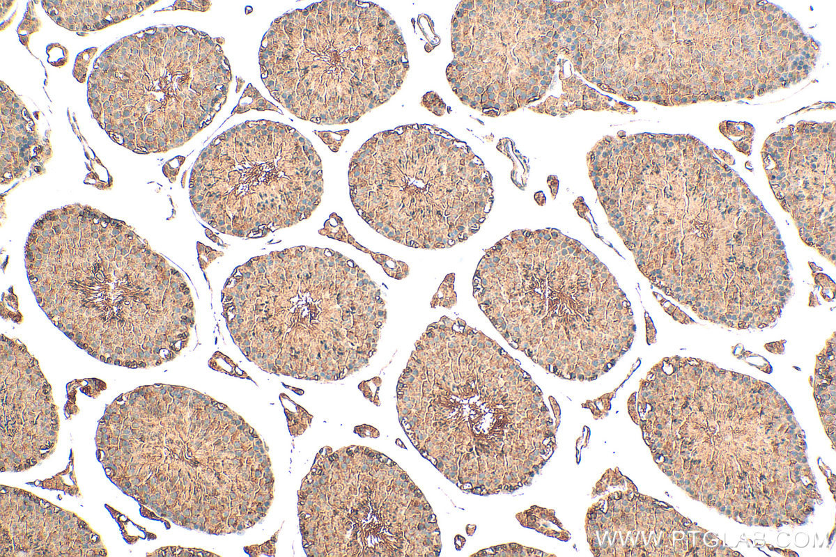 IHC staining of mouse testis using 17460-1-AP