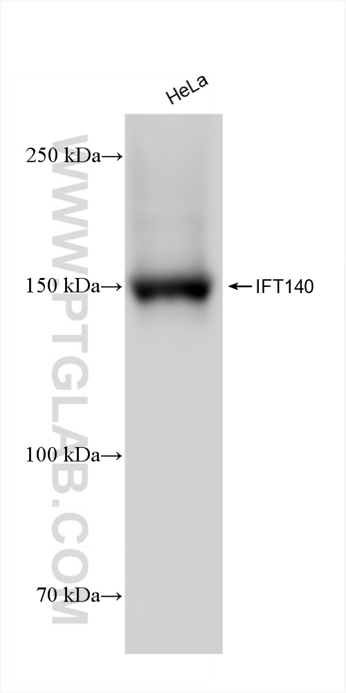 WB analysis of HeLa using 82947-7-RR (same clone as 82947-7-PBS)