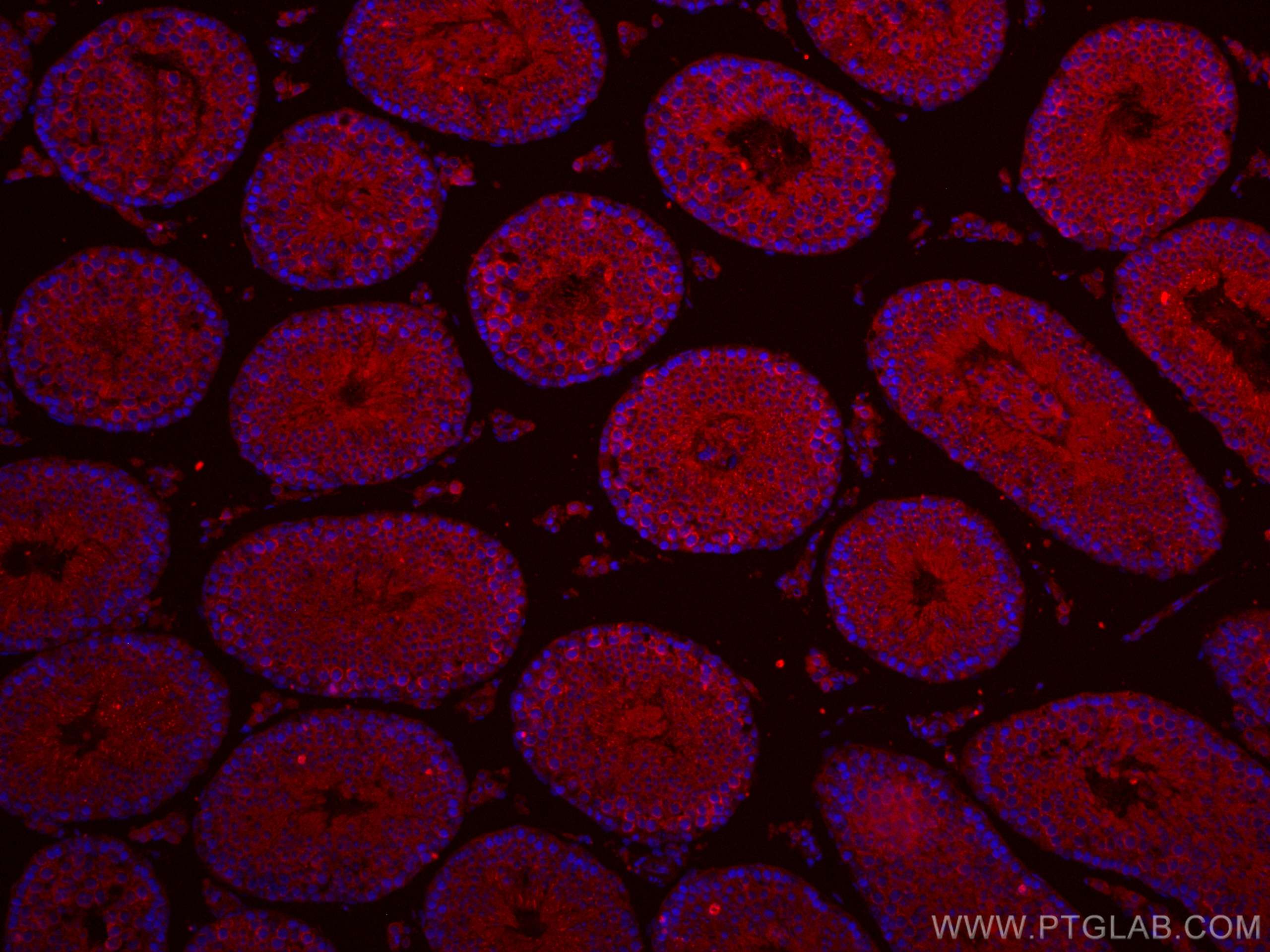 IF Staining of mouse testis using CL594-17460