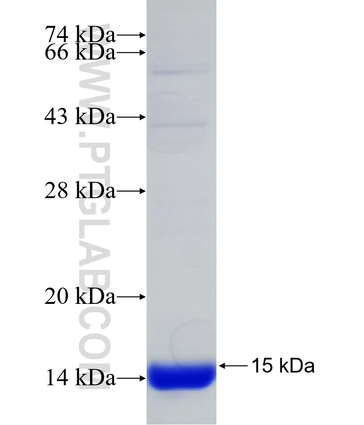 IFT172 fusion protein Ag31399 SDS-PAGE IFT172 fusion protein Ag31399 SDS-PAGE