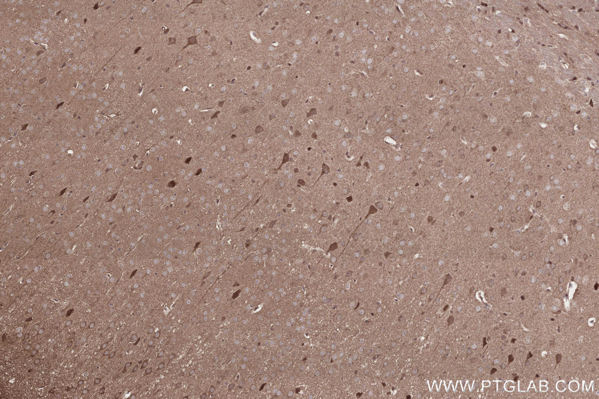 Immunohistochemical analysis of paraffin-embedded mouse brain tissue slide using 13615-1-AP (IFT20 antibody) at dilution of 1:500 (under 10x lens). Heat mediated antigen retrieval with Tris-EDTA buffer (pH 9.0). IHC staining of mouse brain using 13615-1-AP