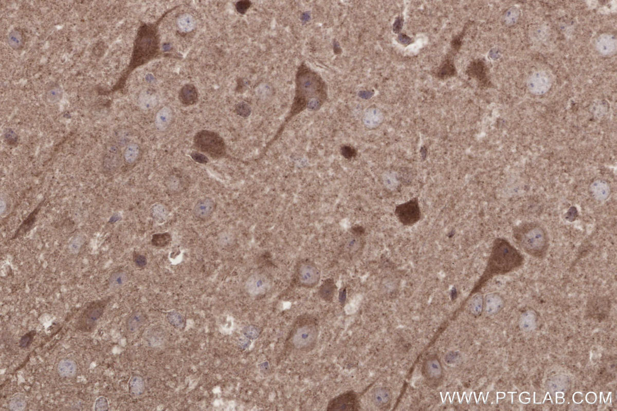 Immunohistochemical analysis of paraffin-embedded mouse brain tissue slide using 13615-1-AP (IFT20 antibody) at dilution of 1:500 (under 40x lens). Heat mediated antigen retrieval with Tris-EDTA buffer (pH 9.0). IHC staining of mouse brain using 13615-1-AP