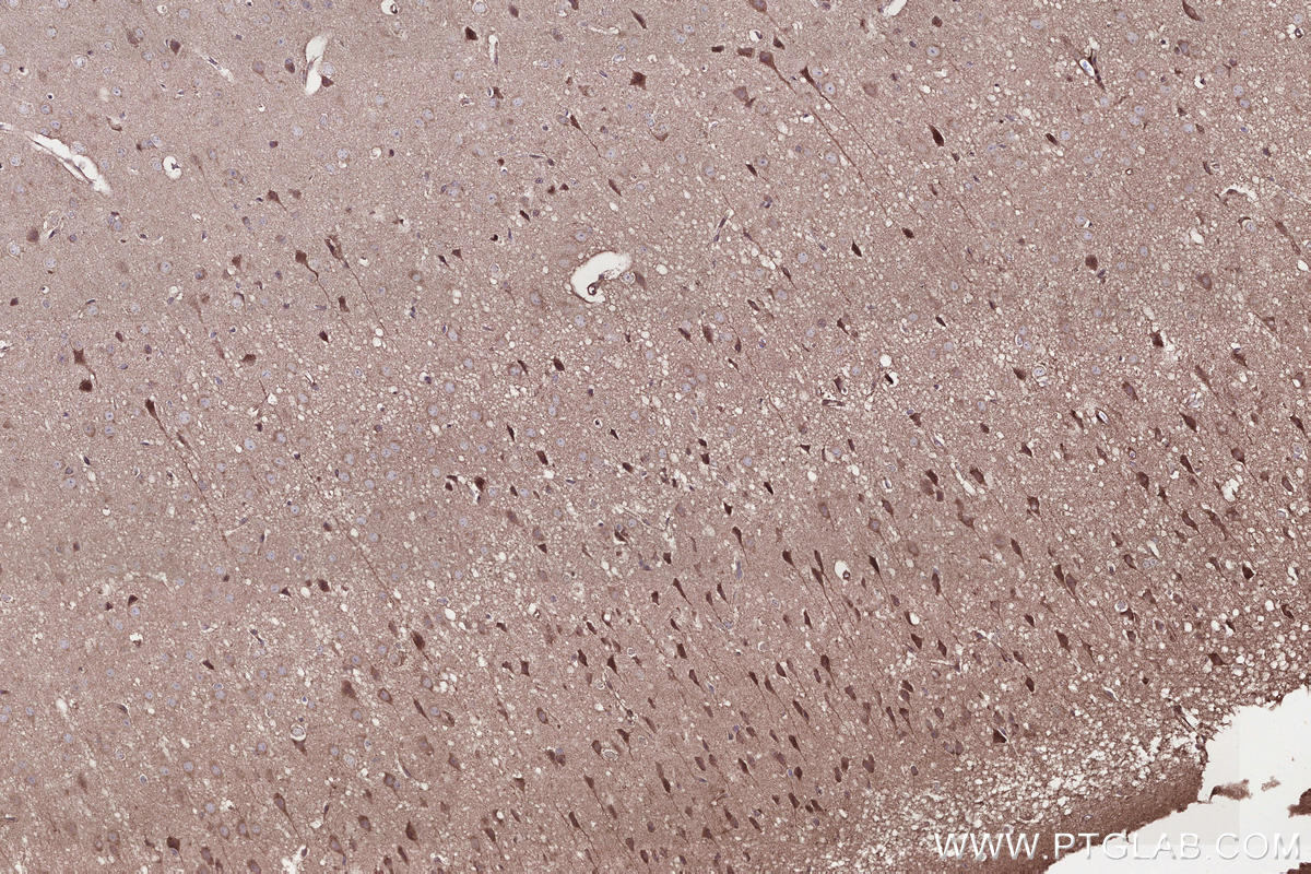 IHC staining of mouse brain using 13615-1-AP IHC staining of mouse brain using 13615-1-AP