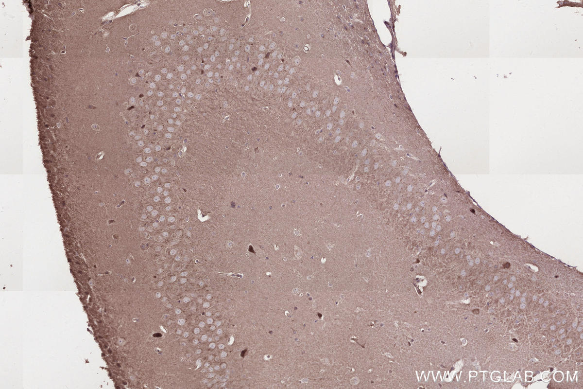 IHC staining of mouse brain using 13615-1-AP IHC staining of mouse brain using 13615-1-AP