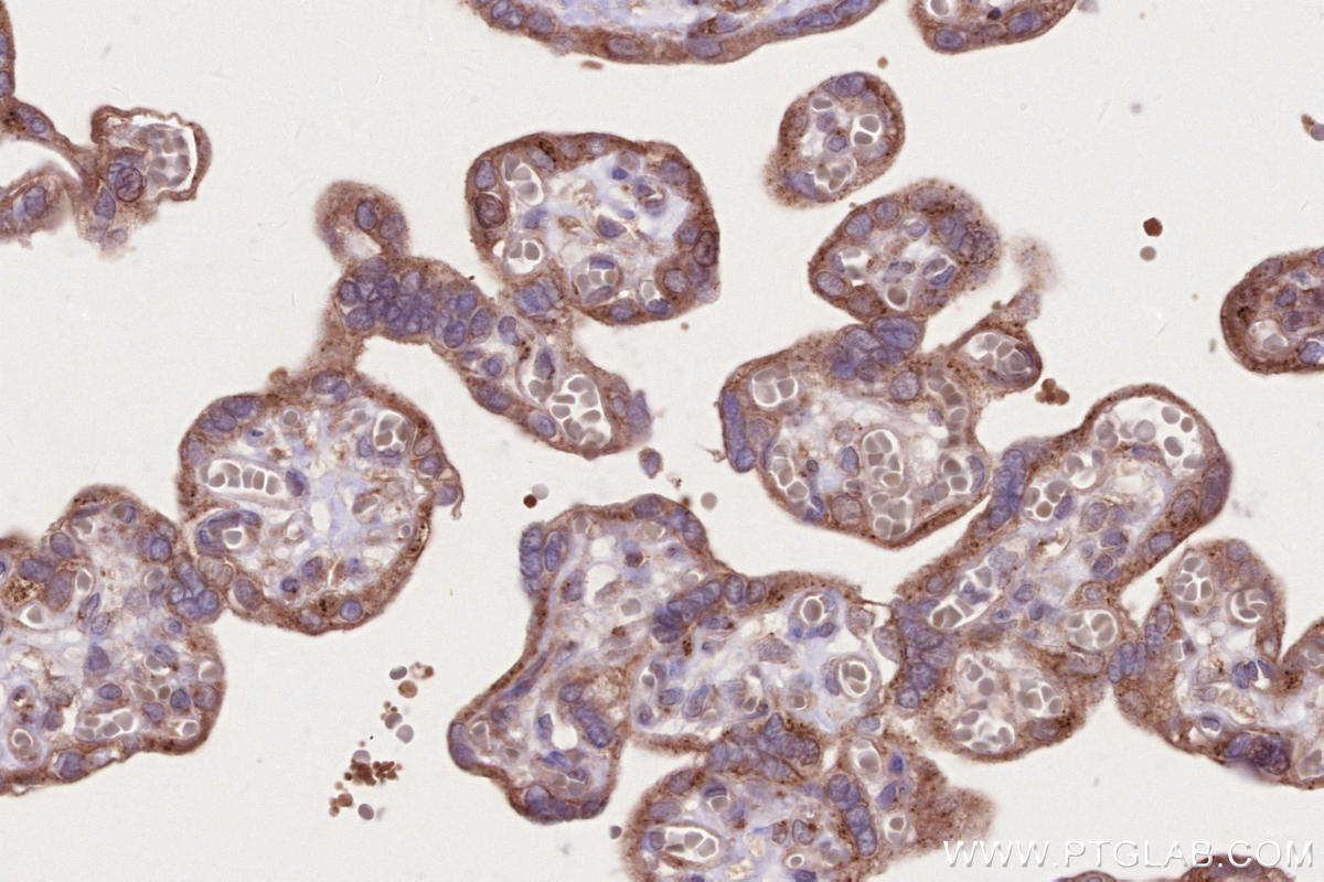 IHC staining of human placenta using 13615-1-AP IHC staining of human placenta using 13615-1-AP