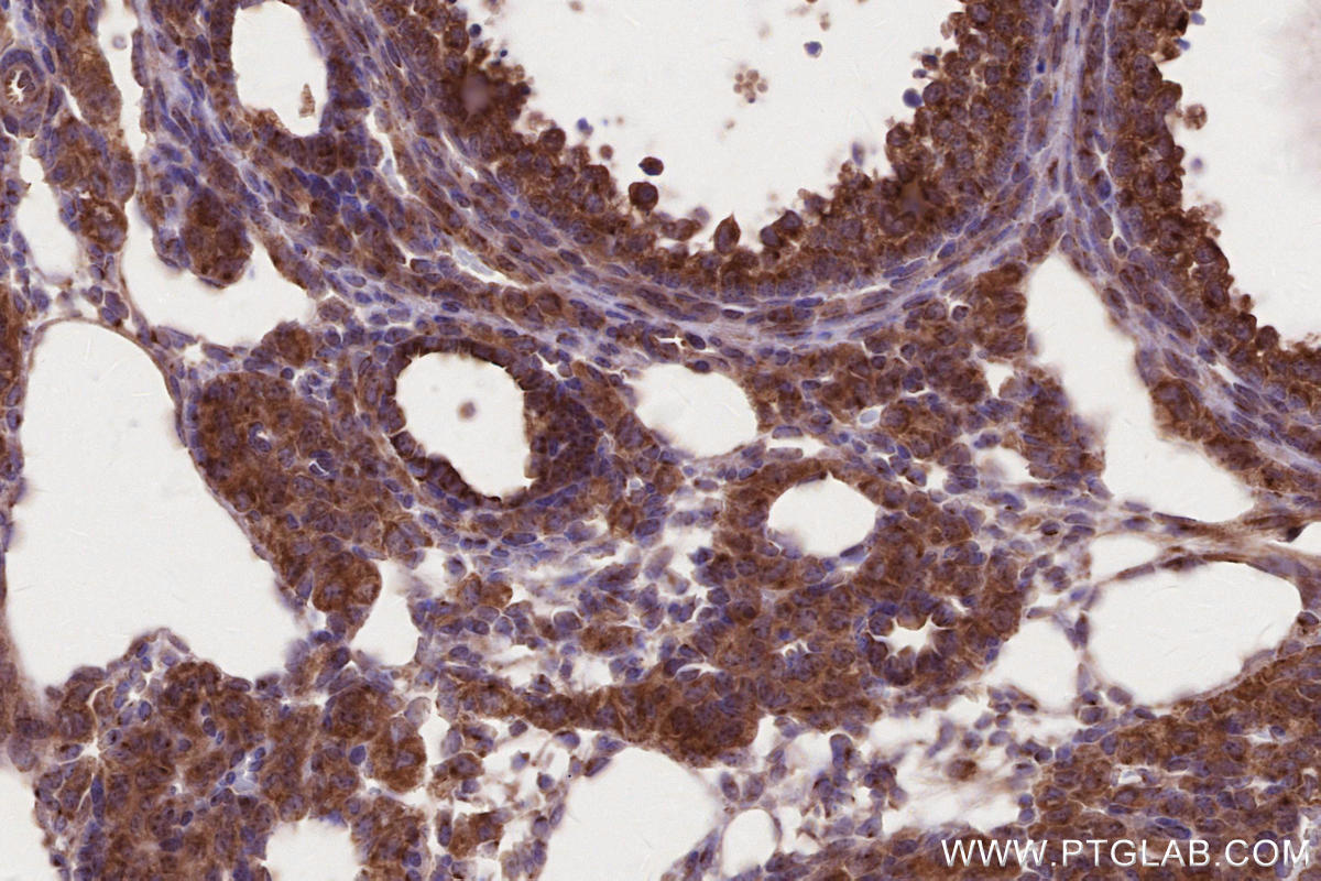 IHC staining of mouse ovary using 13615-1-AP IHC staining of mouse ovary using 13615-1-AP