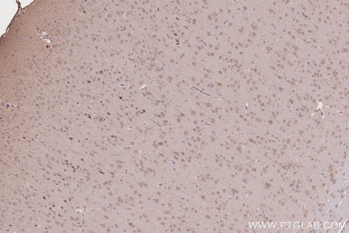 IHC staining of rat brain using 13615-1-AP IHC staining of rat brain using 13615-1-AP