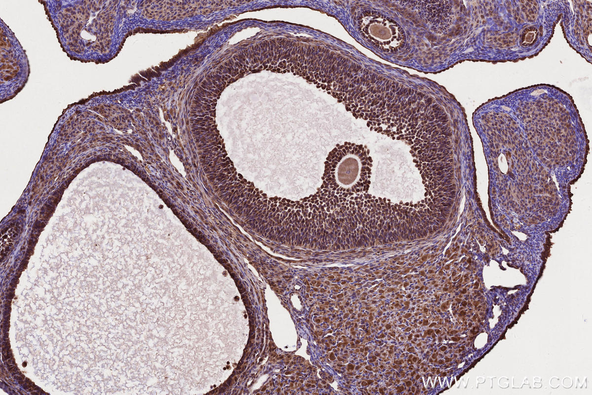IHC staining of rat ovary using 13615-1-AP IHC staining of rat ovary using 13615-1-AP