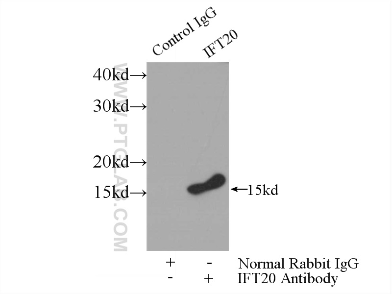 IP experiment of mouse testis using 13615-1-AP