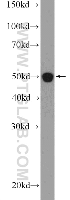 IFT52 Polyclonal antibody