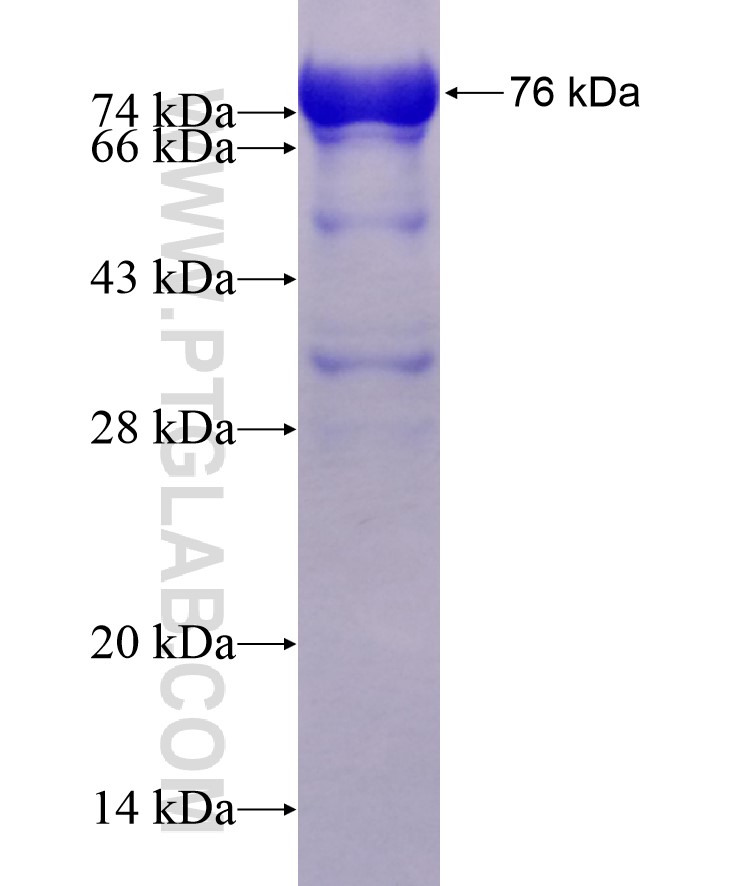 IFT52 fusion protein Ag11586 SDS-PAGE
