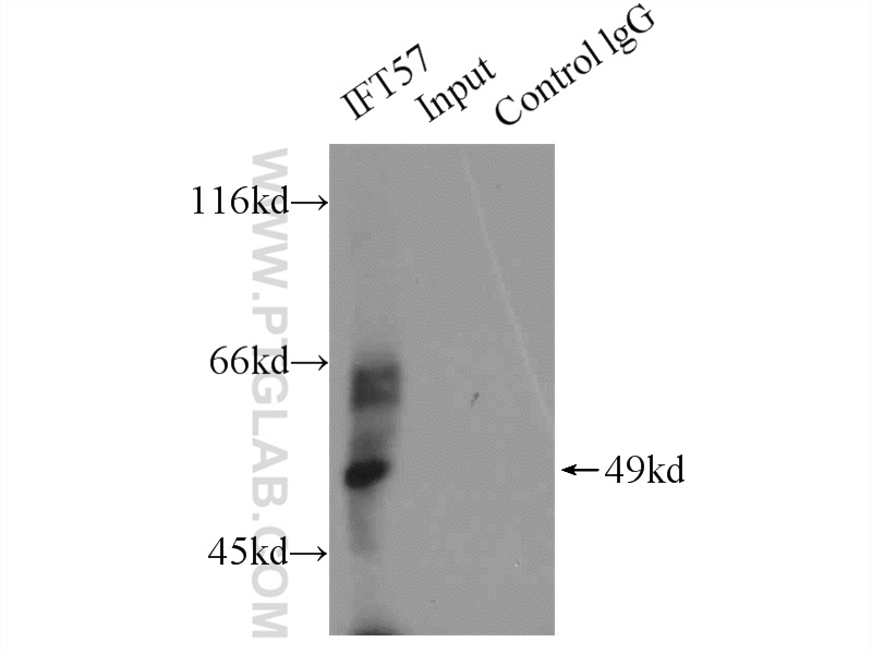 IP experiment of HEK-293 using 11083-1-AP