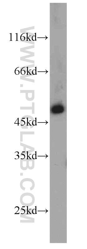 WB analysis of mouse retina using 11083-1-AP