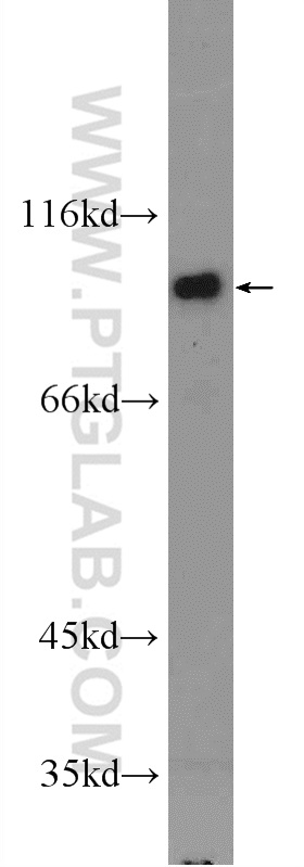 WB analysis of NIH/3T3 using 25230-1-AP