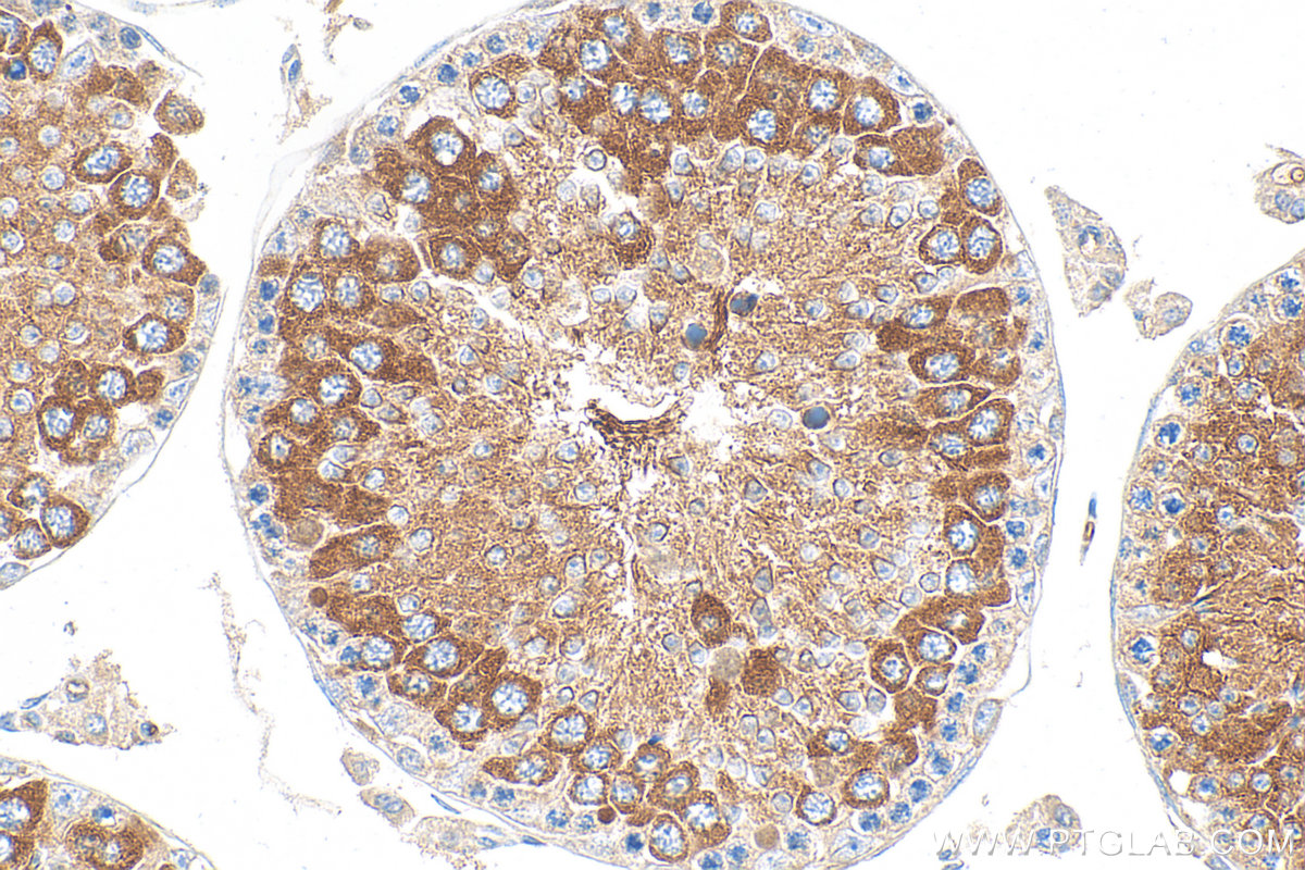 IHC staining of mouse testis using 11744-1-AP